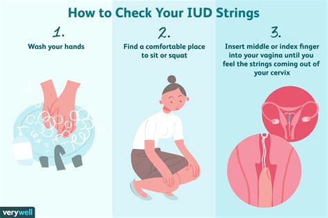 How To Check Your Iud Strings