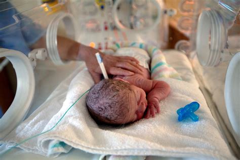 care  premature babies  means harder choices