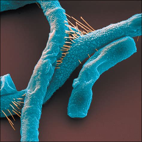 anthrax detection infectious diseases jama  jama network