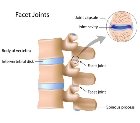 visit  physiotherapist  spinal osteoarthritis simply align rehab