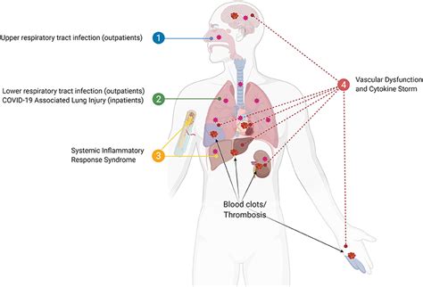 frontiers overview systemic inflammatory response derived  lung