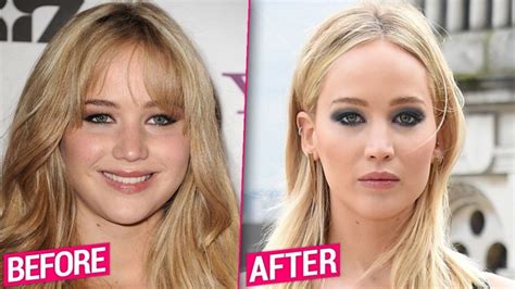 jennifer lawrence plastic surgery before after