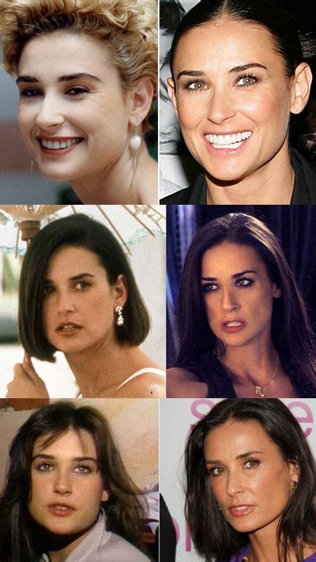 Demi Moore Plastic Surgery Before And After Breast