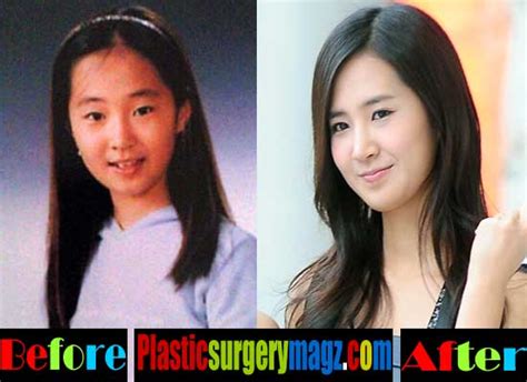 Girls Generation Plastic Surgery Is Finally Revealed