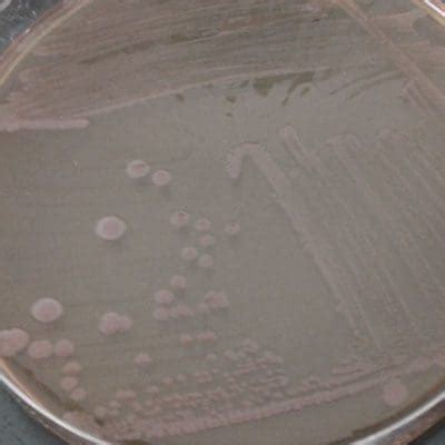 salmonella enterica microchem laboratory