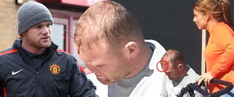 Wayne Rooney S Cut Head Revealed In First Pictures Of Wound Graphic
