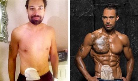 Bodybuilder Poses With Colostomy Bag As He Overcomes Devastating