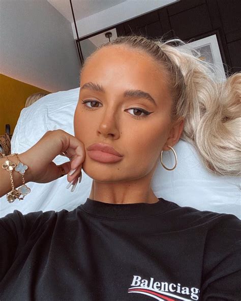 Love Island S Molly Mae Hague Has Had Her Lip Fillers Dissolved Kiss