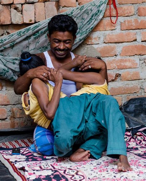 Conjoined Twins From India Fell In Love For The First Time