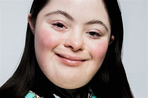 Ellie Goldstein Is The Pioneer For Models With Down’s Syndrome Dazed