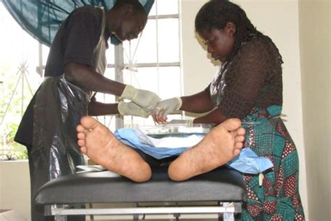 How Long Does One Take To Heal After Circumcision Daily Monitor