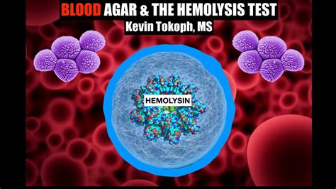 blood   hemolysis test theory results youtube