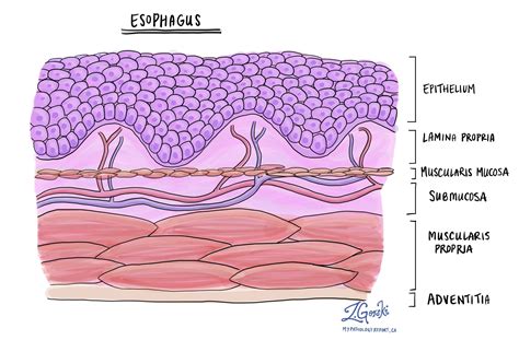 reflux esophagitis mypathologyreportca