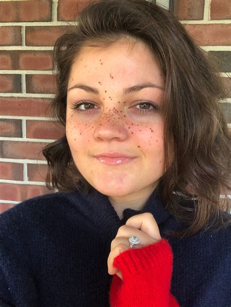 Tattooing Freckles On Your Face Is The New Beauty Craze And They Look