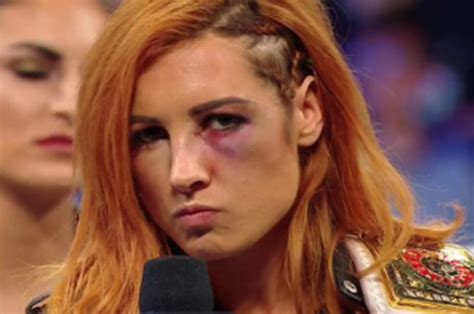 becky lynch wwe star breaks silence on broken face and reveals rousey s new opponent
