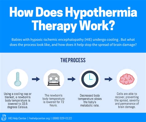 hypothermia treatment heart attack patients english edition