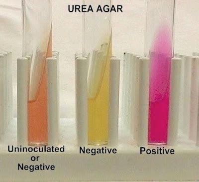 urease test microbiology lab notes