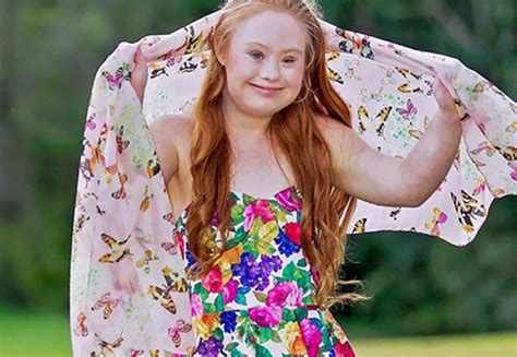 teen with down syndrome lands two modeling jobs