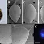 Afbeeldingsresultaten voor "prorocentrum Foraminosum". Grootte: 150 x 150. Bron: www.researchgate.net