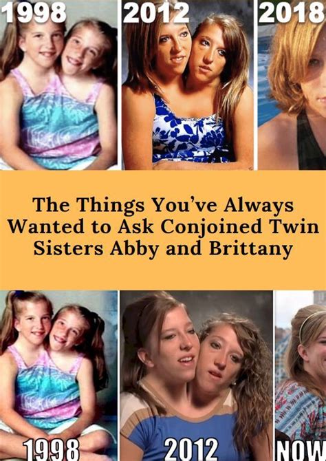 The Things You’ve Always Wanted To Ask Conjoined Twin Sisters Abby And