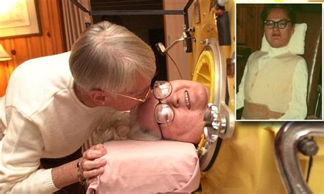 The Woman Who Lived In An Iron Lung For 61 Years Daily Mail Online