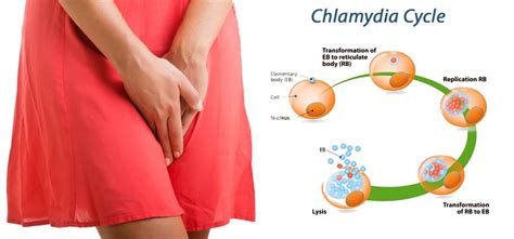 9 Effective Home Remedies For Chlamydia In Men And Women