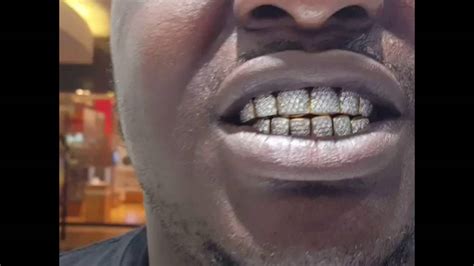 gold teeth  diamonds youtube