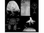 Afbeeldingsresultaten voor Chiropsalmus quadrumanus Klasse. Grootte: 150 x 112. Bron: www.researchgate.net