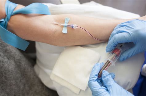 arterial blood gas procedure