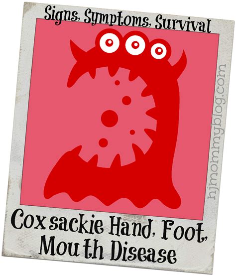 Coxsackie Hand Foot Mouth Disease Signs Symptoms