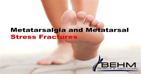 Metatarsal Stress Fractures Behm Muscle And Joint Clinic
