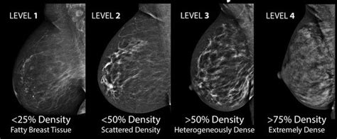 common breast cancer types and ultrasound images interpretation new health advisor