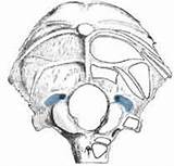 Occipital Condylar Osteology Fossae Quia Bones Vault Features sketch template