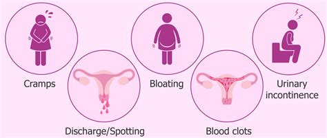 Potential Side Effects And Complications After Endometrial Ablation