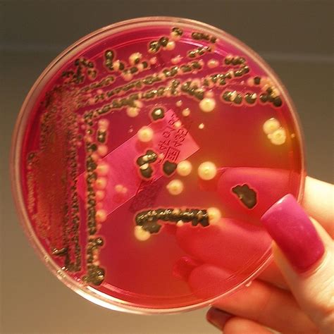 salmonella outbreak  darwin department  health confirms  cases