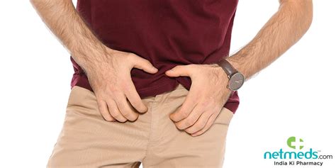 jock itch tinea cruris causes symptoms and treatment