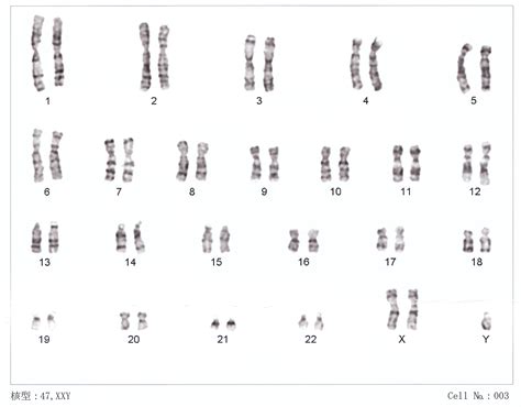 identifican alteraciones cromosómicas asociadas a la disforia de género noticias sinc