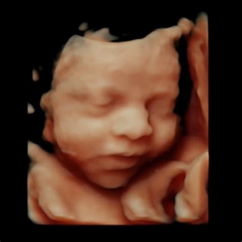 baby pix dd ultrasound studio youtube