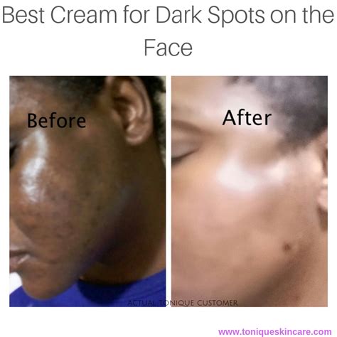 cream  dark spots   face tonique skincare