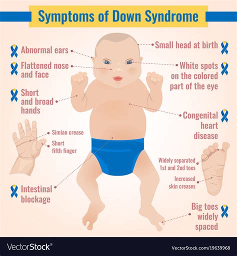 syndrom symptoms royalty  vector image