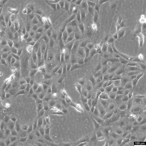 vero  cells str verified   mycoplasma cls