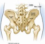 Images of Sports Injury Hip Pointer