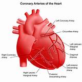 Coronary Artery Diagram Images
