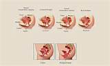Different Types Uterus Images