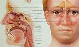 Pictures of Sinus Infection Symptoms