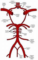 Internal Carotid Artery Quiz Images