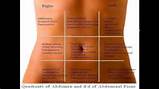 Acute Pain Stomach Pictures