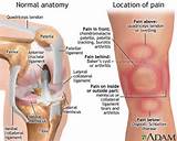 Acute Pain Behind Knee Photos