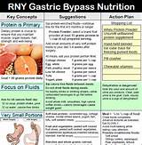 Photos of Gastric Bypass Diet Plan