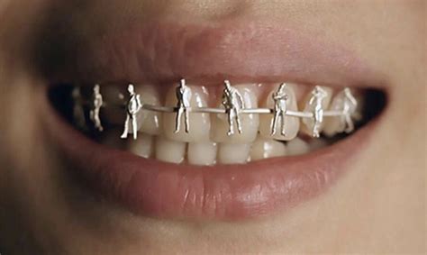 pin de 𝐗𝐞𝐧 ♡ en art brackets dentales lápices labiales